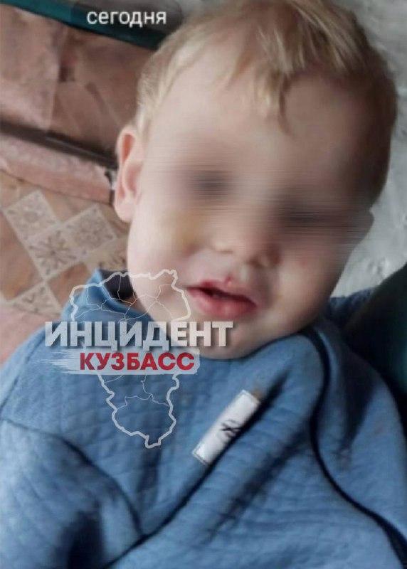 В Кузбассе мать-алкоголичка избивает и не кормит детей, а органы опеки...