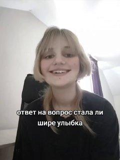 У поколения зумеров появился новый странный тренд — они подрезают уголки рта.