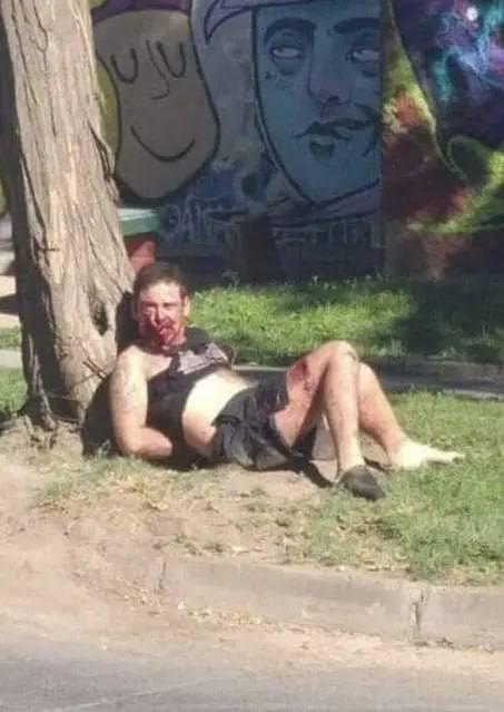 В США пенсионер прострелил челюсть вору, который пытался пробраться в его дом