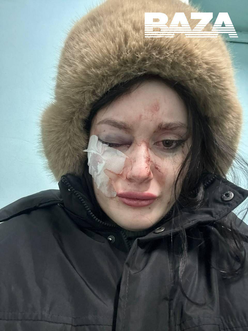 Девушка обвиняет мужа в том, что он лишил её зрения — во время ссоры кинул...