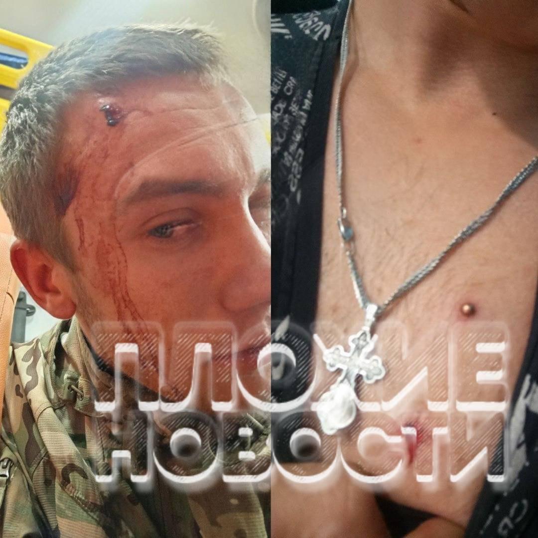 В Крыму подростки расстреляли из пистолета семью за просьбу унять...
