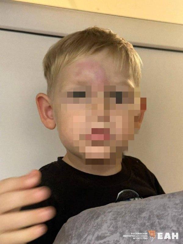 Лавочка перевернулась на трёхлетнего ребёнка в «Баден-Бадене» на Уктусе....