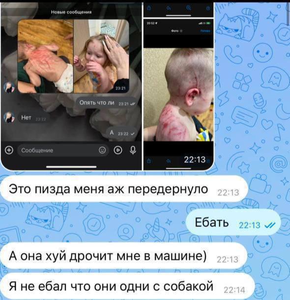 В Челябинске собака растерзала двоих детей, пока мать развлекалась с любовником в машине.