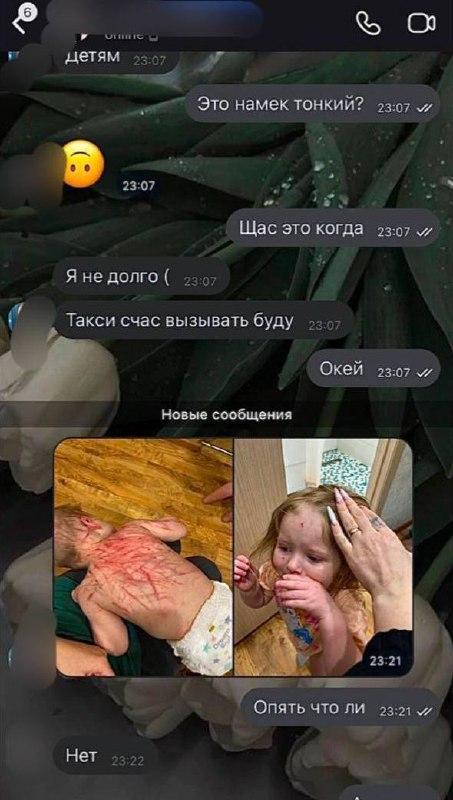 В Челябинске собака растерзала двоих детей, пока мать развлекалась с любовником в машине.