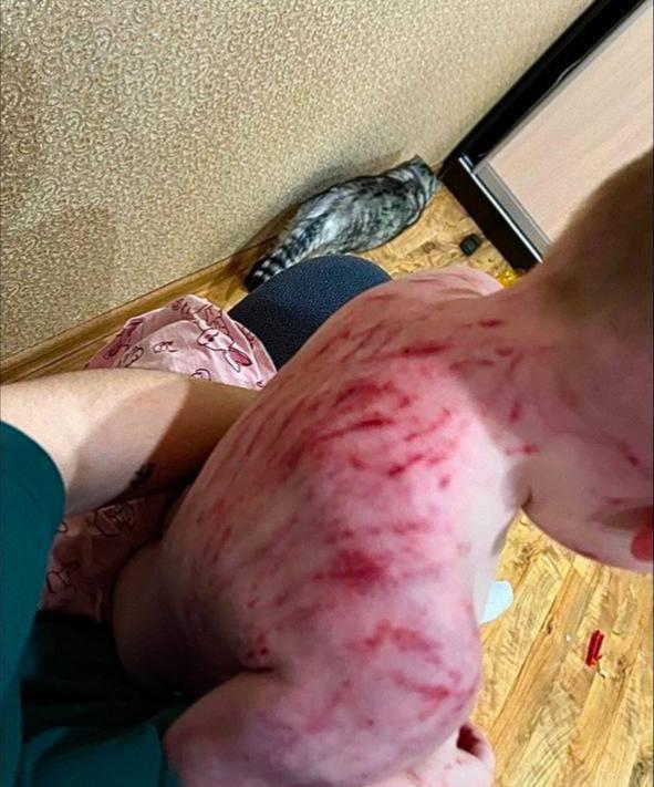 В Челябинске собака растерзала двоих детей, пока мать развлекалась с любовником в машине.