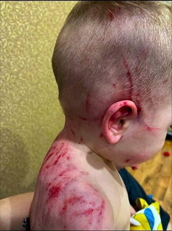 В Челябинске собака растерзала двоих детей, пока мать развлекалась с любовником в машине.