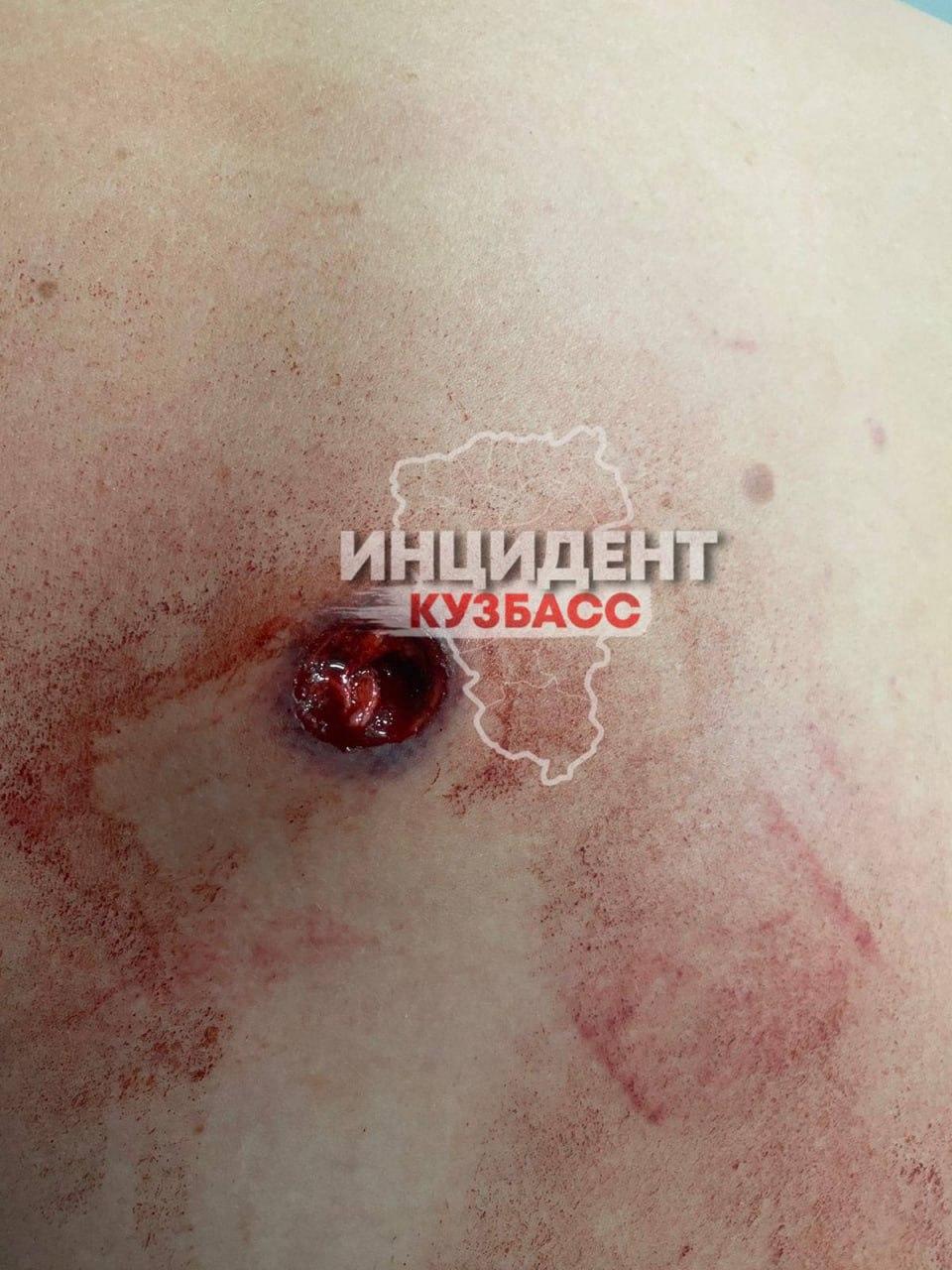 В Кузбассе мужчина получил пулевые ранения во время конфликта с соседом, но в...