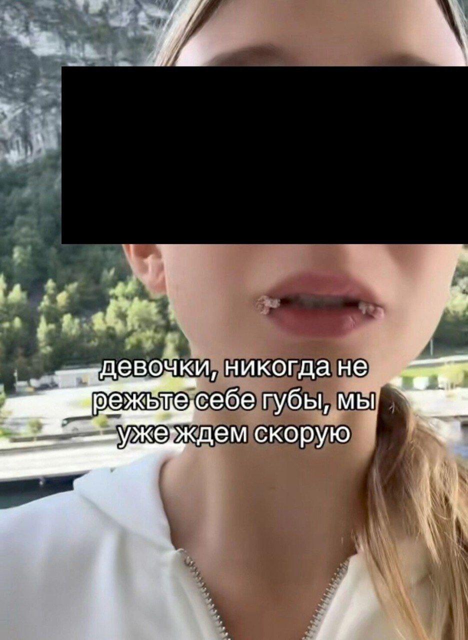 «Улыбка Джокера»: новосибирские подростки массово режут рот из-за опасного...