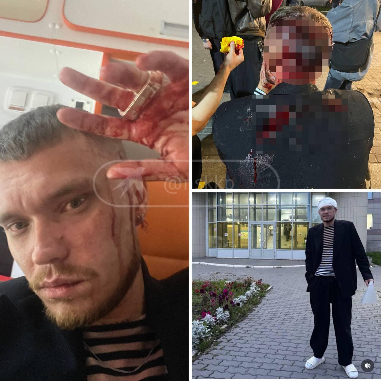 Блогеру Ефиму Стрелкову разбили голову у бара в Новосибирске