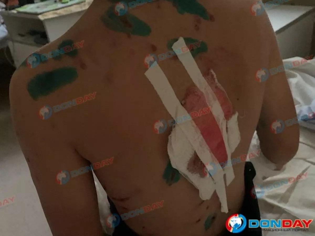 Третьеклассник чуть не стал жертвой домашнего волка, к которому пошёл познакомиться вместе с друзьями.