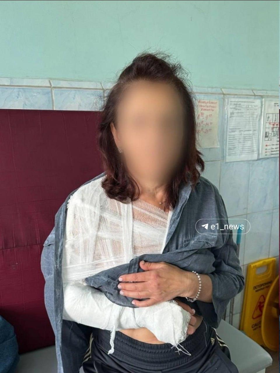 Жительница Алапаевска упала в яму и сломала руку По словам дочери...