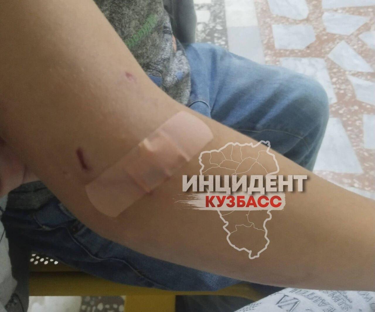 Кемеровчанка сообщила о нападении собаки на ее семилетнего сына