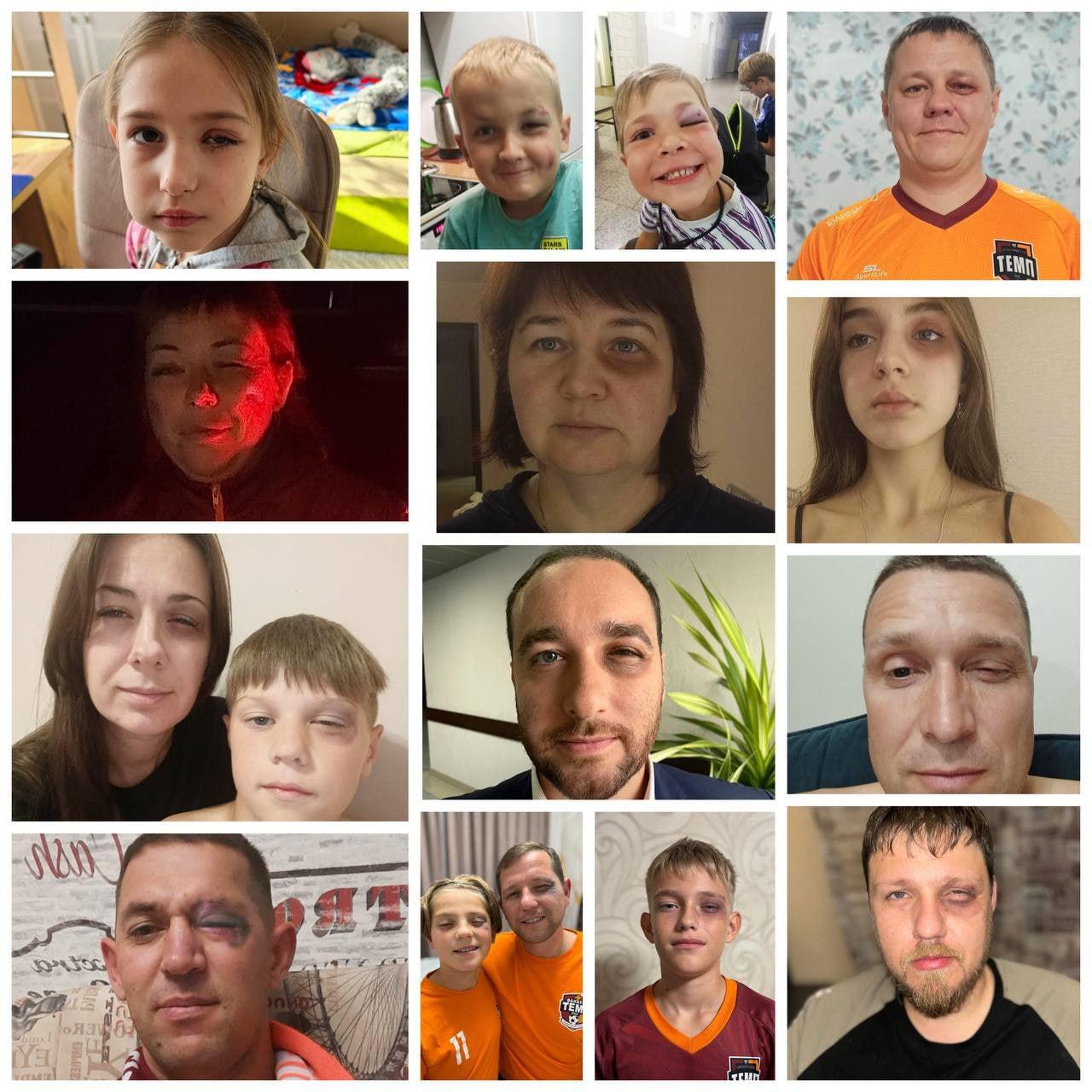 «Они не дрались специально ради этого». Болельщики футбольной команды из Барнаула устроили «фингальный» флешмоб. Так они поддержали игрока, получившего сильный удар по лицу от соперника.