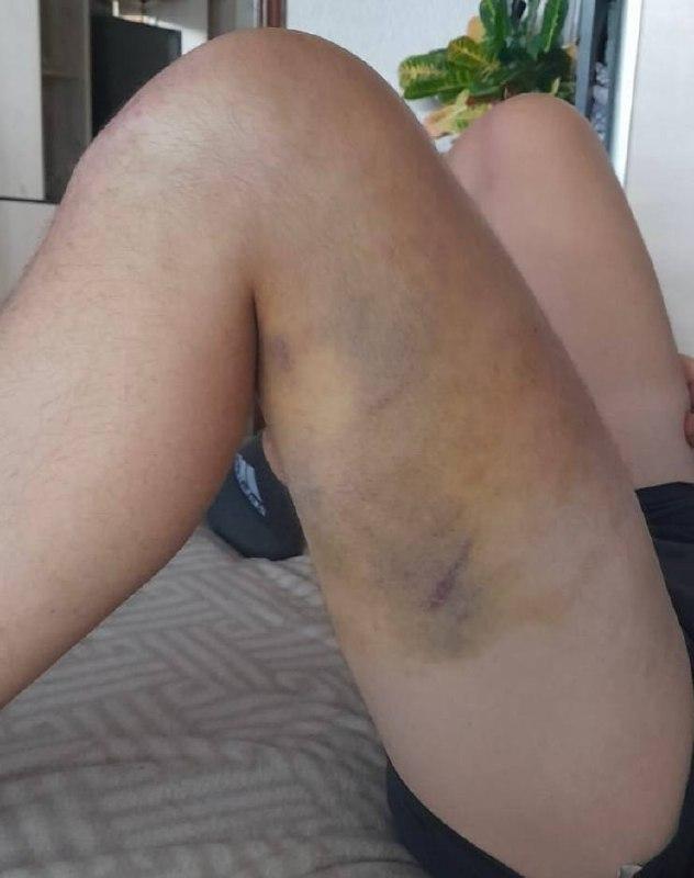 В Ярославле полицейские избили супругов, требуя информацию об их знакомом, утверждает «Общественный вердикт»*.