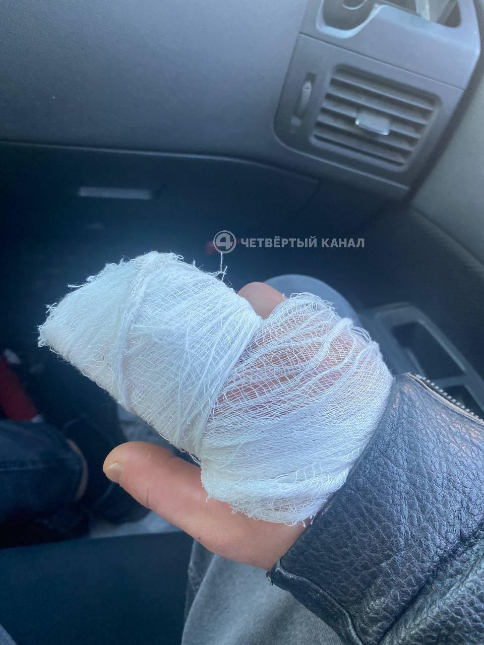 Аппарат для хинкали зажевал руку повара