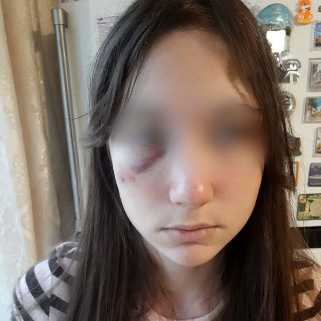 В Ростове бывший муж третий год избивает возлюбленную — так он добивается воссоединения. Девушка пять раз обращалась в полицию, но все тщетно
