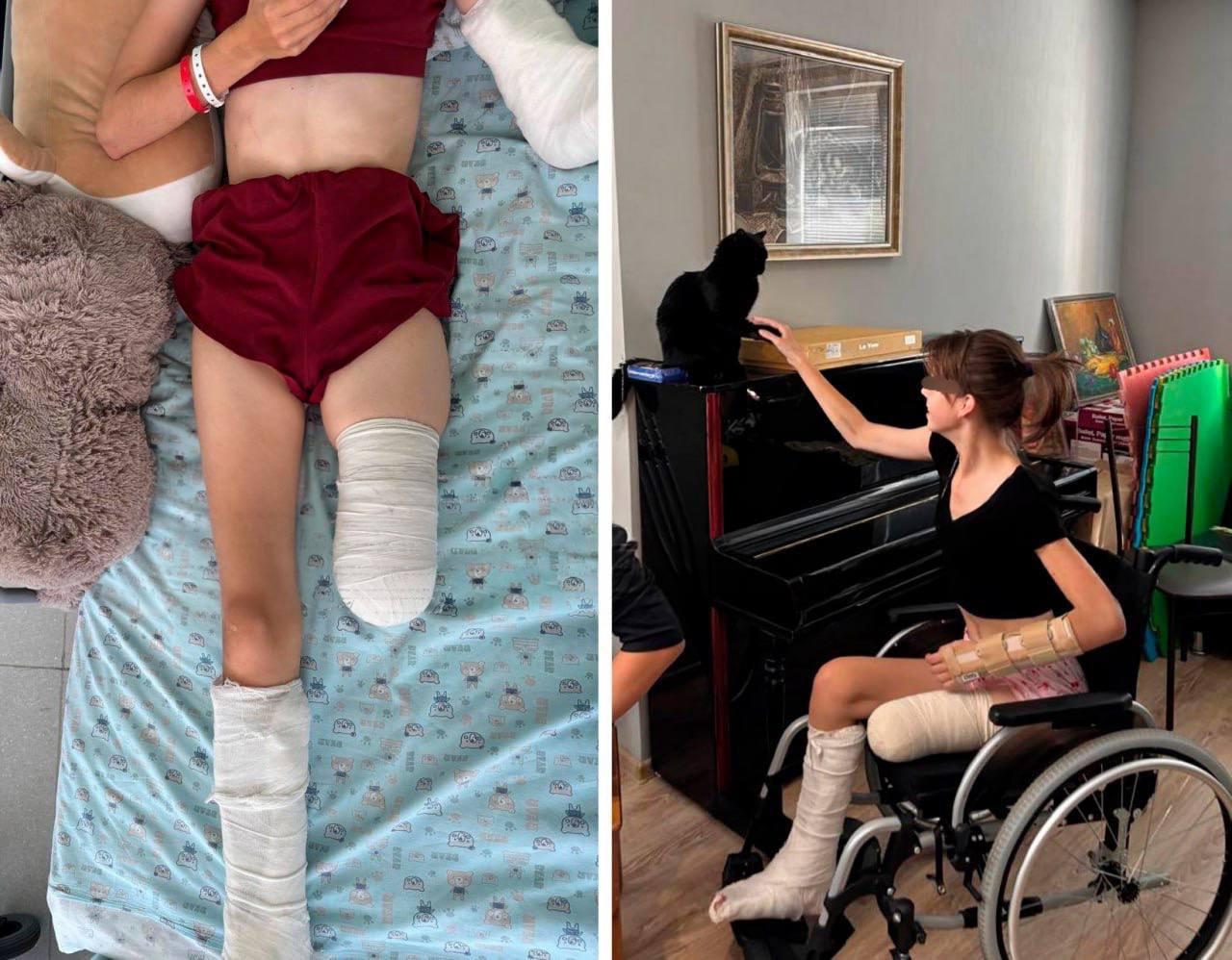 Пьяный водитель сбил 15-летнюю девушку на Калужском шоссе