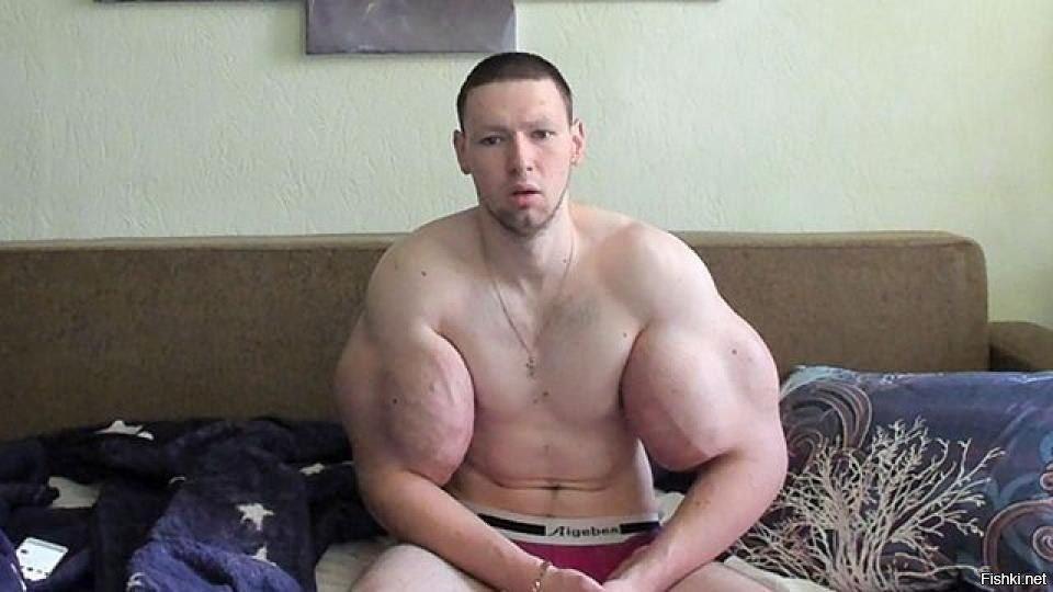 У 29-летнего Кирилла Терёшина начала гнить рука. В своё время парень...