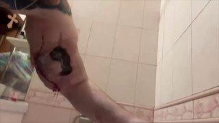 У 29-летнего Кирилла Терёшина начала гнить рука. В своё время парень...