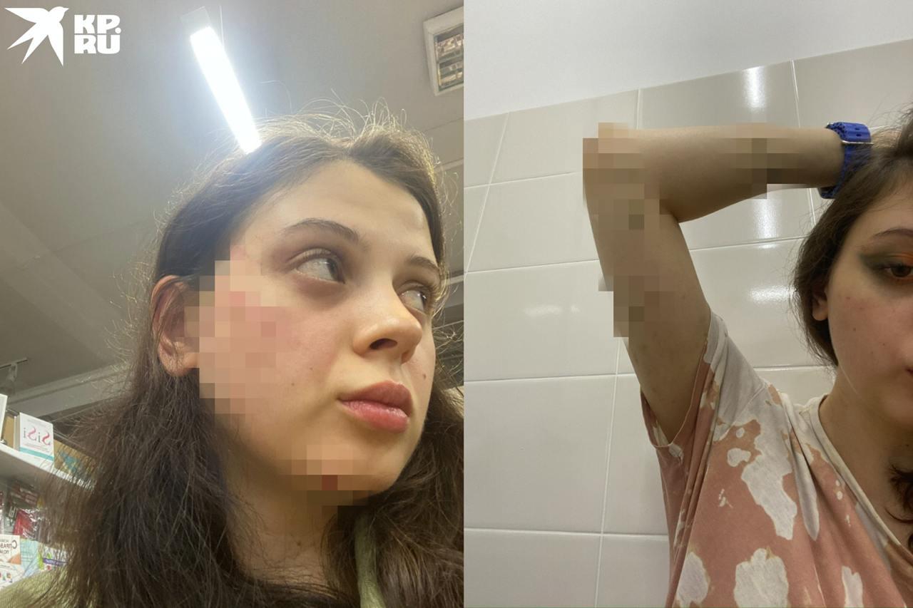 «Преследовал, шантажировал откровенным видео»: в Новосибирске студентка обвинила бывшего парня в избиениях