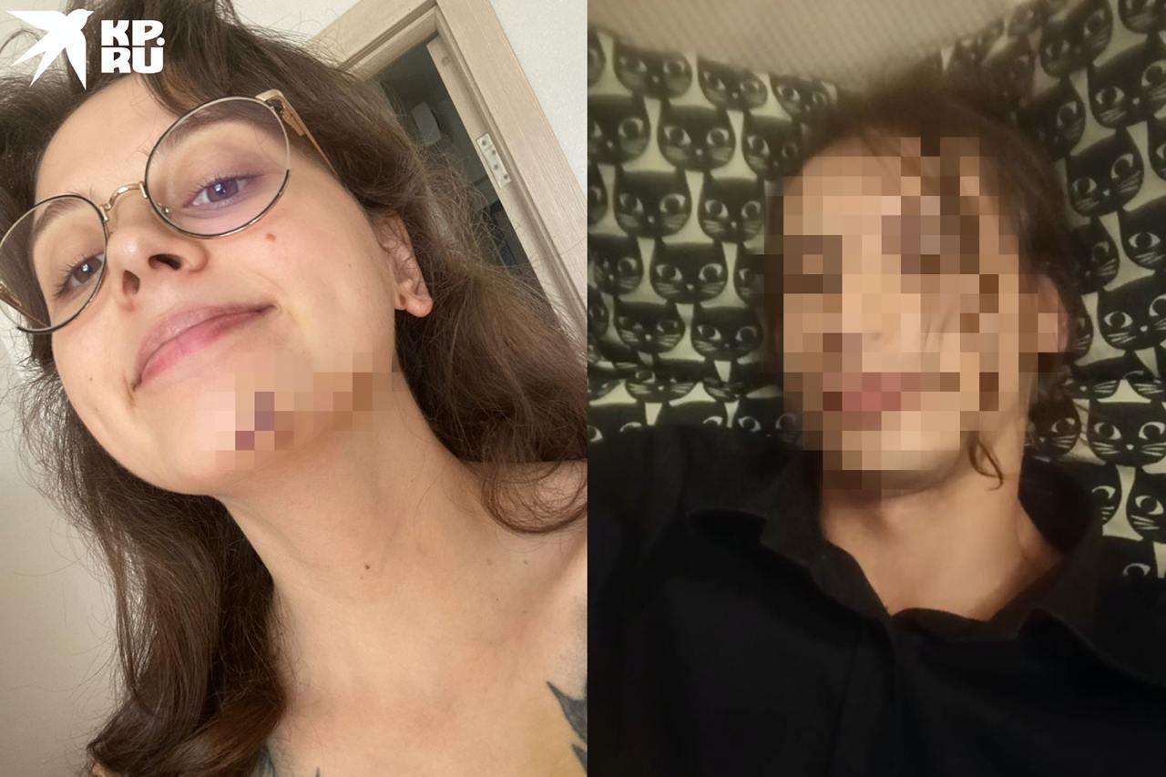 «Преследовал, шантажировал откровенным видео»: в Новосибирске студентка обвинила бывшего парня в избиениях