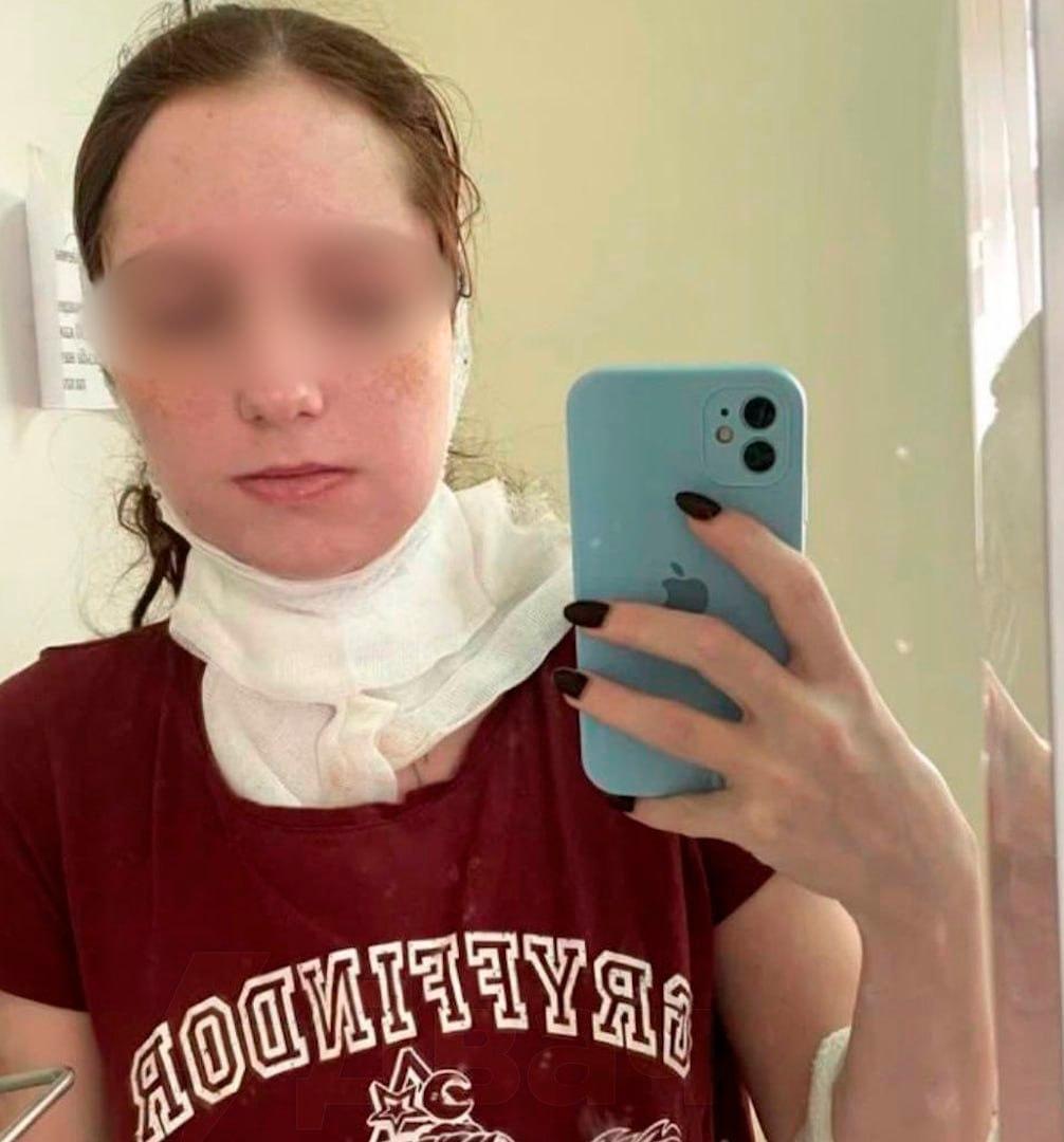 Жительница Подмосковья оказалась в реанимации после удаления зуба мудрости в платной клинике