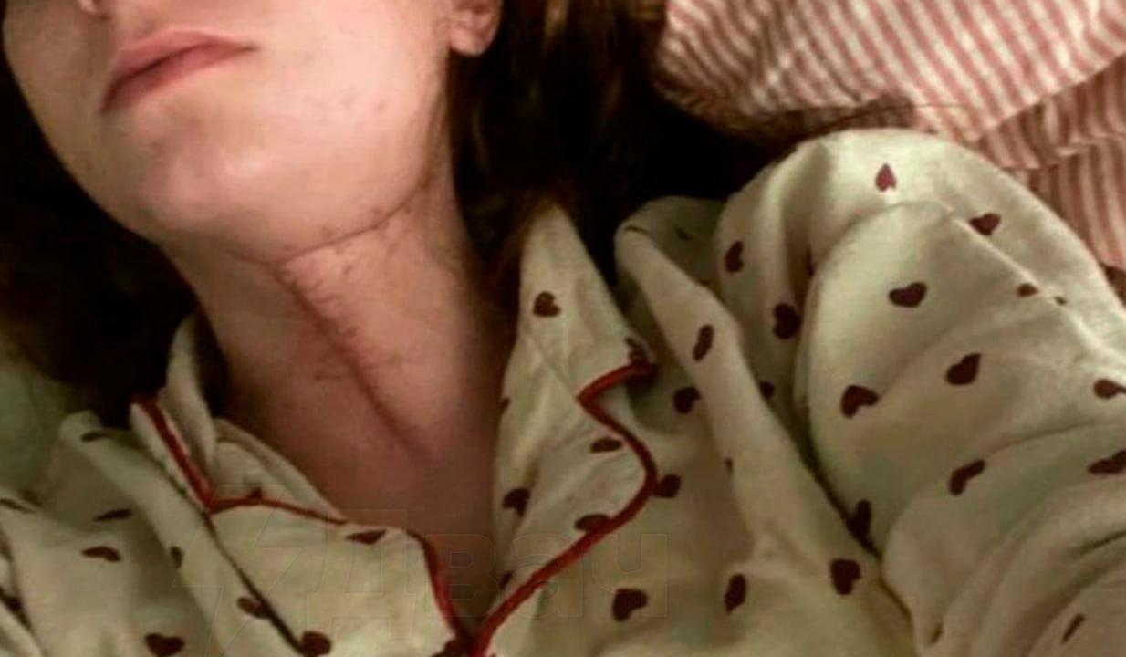 Жительница Подмосковья оказалась в реанимации после удаления зуба мудрости в платной клинике