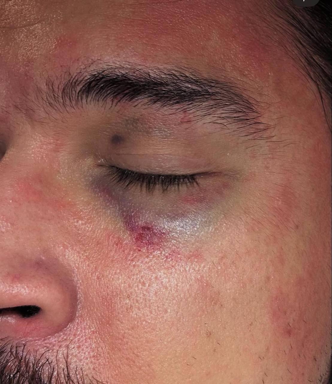 Московского дизайнера избили и ограбили в туалете. Вечер 25 октября прошёл...