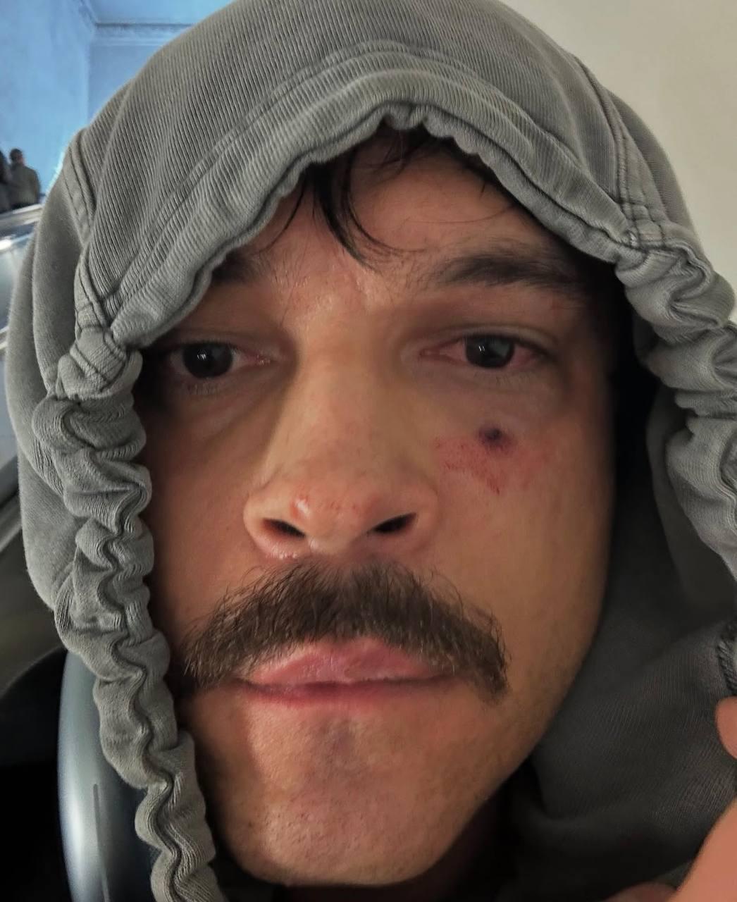 Московского дизайнера избили и ограбили в туалете. Вечер 25 октября прошёл...