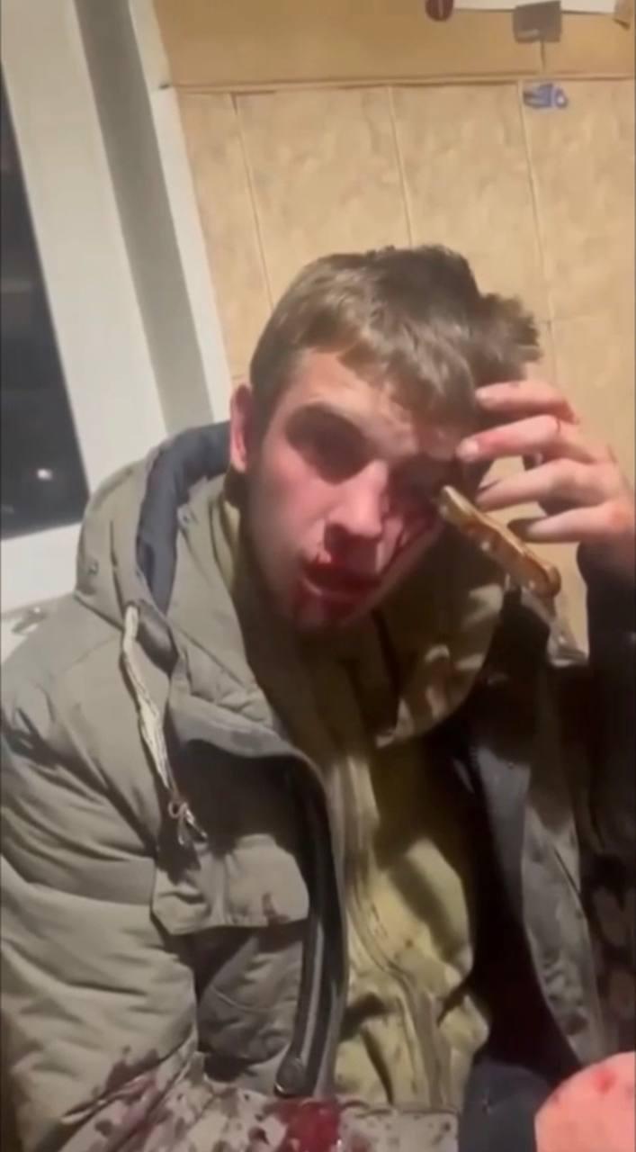 Нах*й ты ему нож в глаз воткнула?! Он сказал, что я у тебя сосала ху* В...