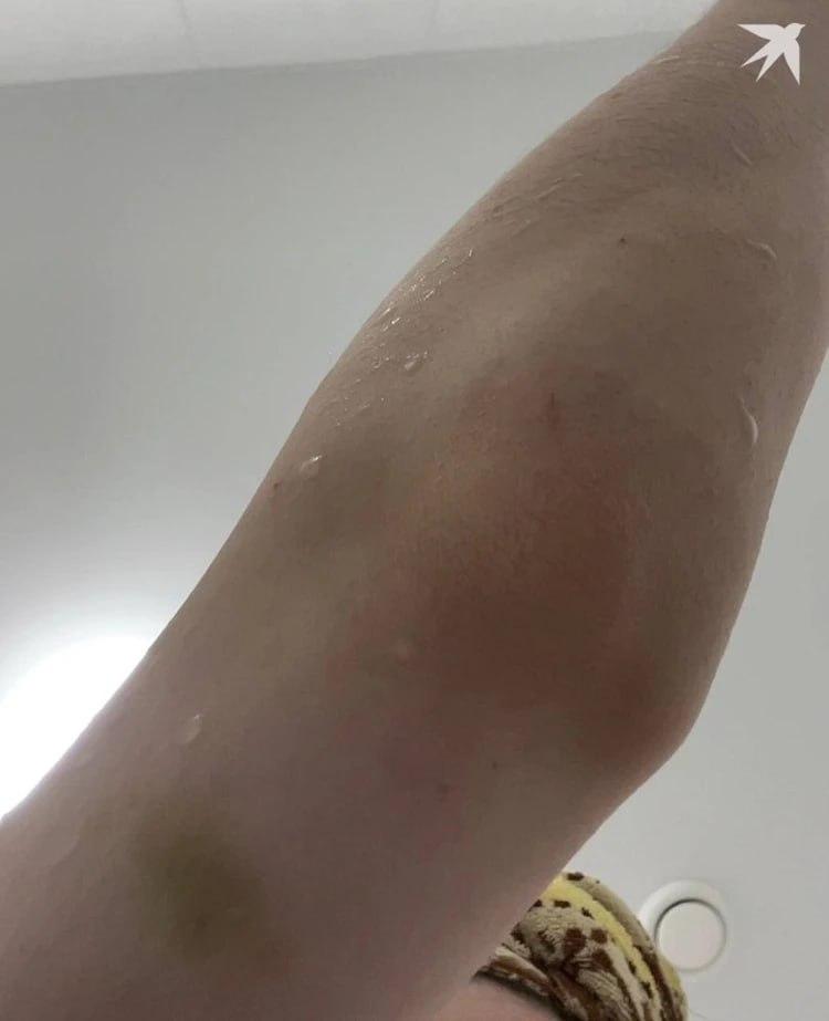 Екатеринбурженка обвинила бывшего парня в побоях По данным канала «КП -...