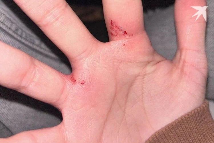 Екатеринбурженка обвинила бывшего парня в побоях По данным канала «КП -...