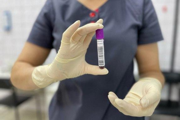 982 белгородца подали заявки на донорство костного мозга с начала года. Заявления на вступление в Федеральный регистр поступили через Госуслуги, сообщили в правительстве региона.