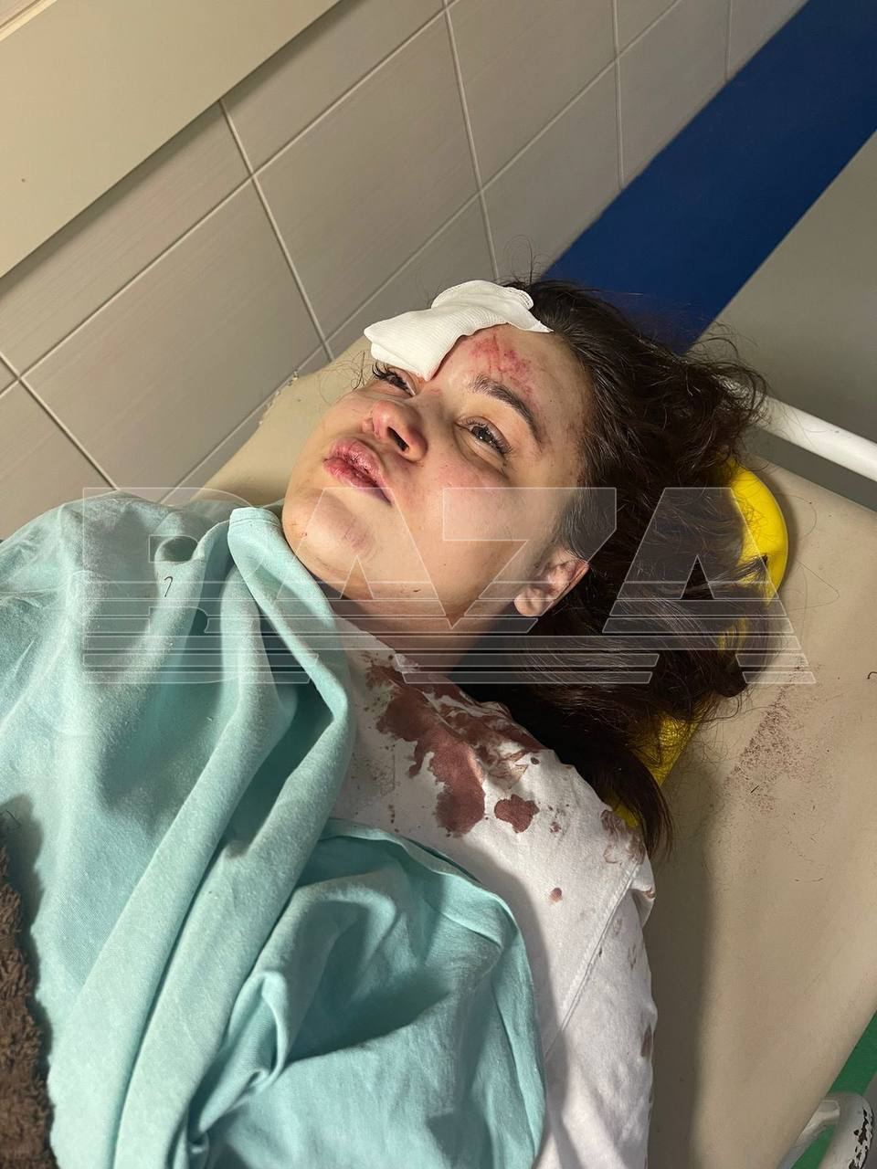 В Подмосковье дрифтер вылетел на встречку и сбил девушку...