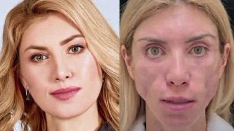 Страшная история модели из Сочи, которая почти шесть лет судилась с клиникой, получила финал